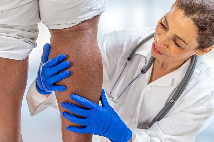 inspecting a woman's leg for varicose veins