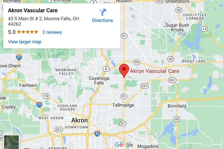 Google map of Cleveland fibroid doctor