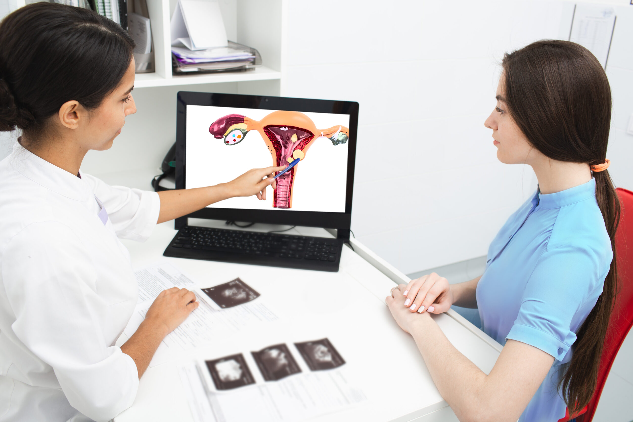 Fibroid doctor